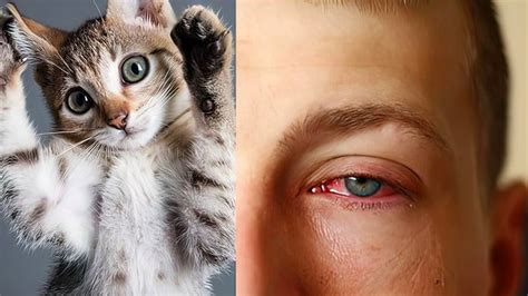alergia a gato sintomas